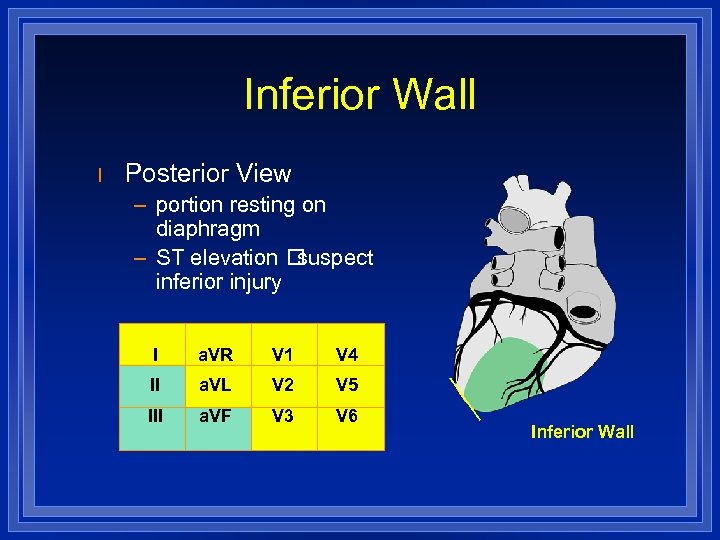 Inferior Wall l Posterior View – portion resting on diaphragm – ST elevation suspect