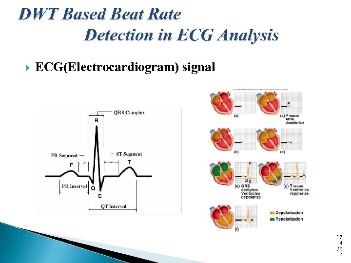 DWT Based Beat Rate Detection in ECG Analysis ECG(Electrocardiogram) signal 17 4 /2 2