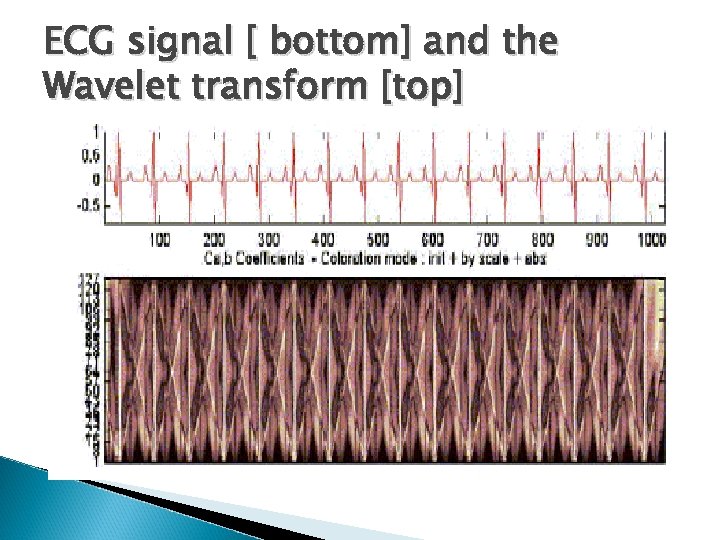 ECG signal [ bottom] and the Wavelet transform [top] 