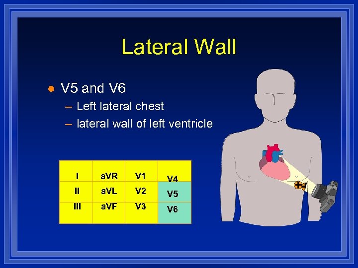 Lateral Wall l V 5 and V 6 – Left lateral chest – lateral
