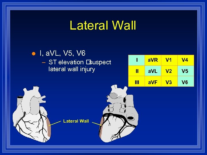 Lateral Wall l I, a. VL, V 5, V 6 Lateral Wall I a.