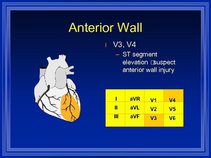 Anterior Wall l V 3, V 4 – ST segment elevation suspect anterior wall