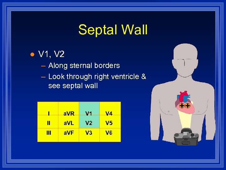 Septal Wall l V 1, V 2 – Along sternal borders – Look through