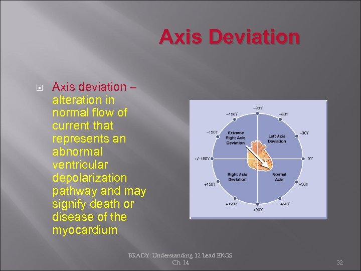 Axis Deviation Axis deviation – alteration in normal flow of current that represents an