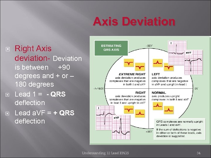 Axis Deviation Right Axis deviation- Deviation is between +90 degrees and + or –
