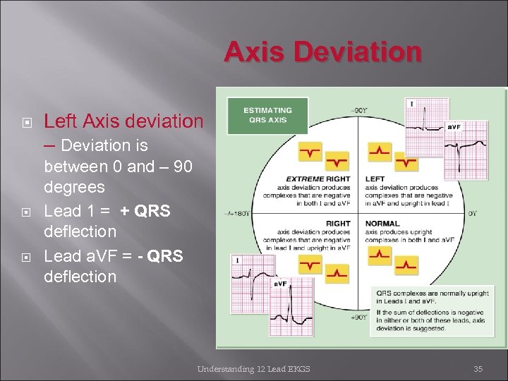 Axis Deviation Left Axis deviation – Deviation is between 0 and – 90 degrees
