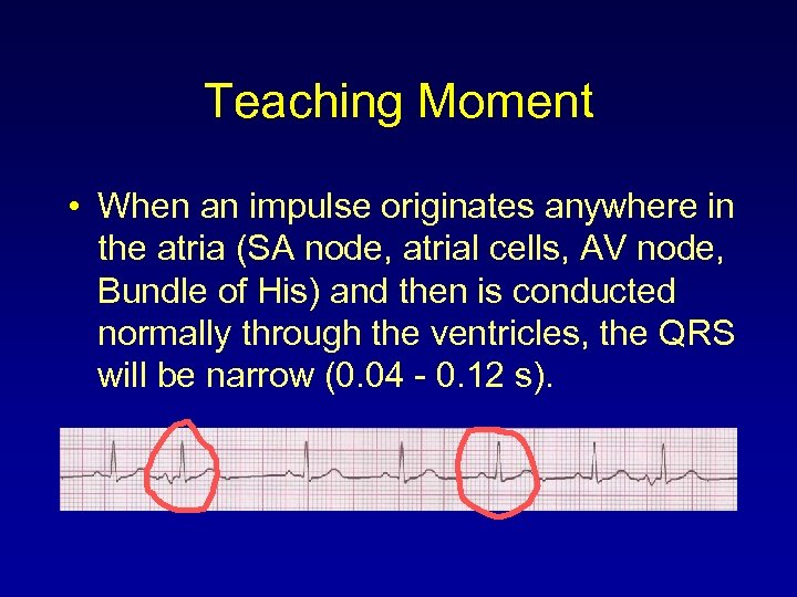 Teaching Moment • When an impulse originates anywhere in the atria (SA node, atrial