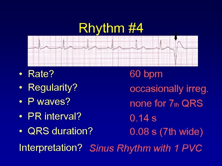 Rhythm #4 • • • Rate? Regularity? P waves? PR interval? QRS duration? 60