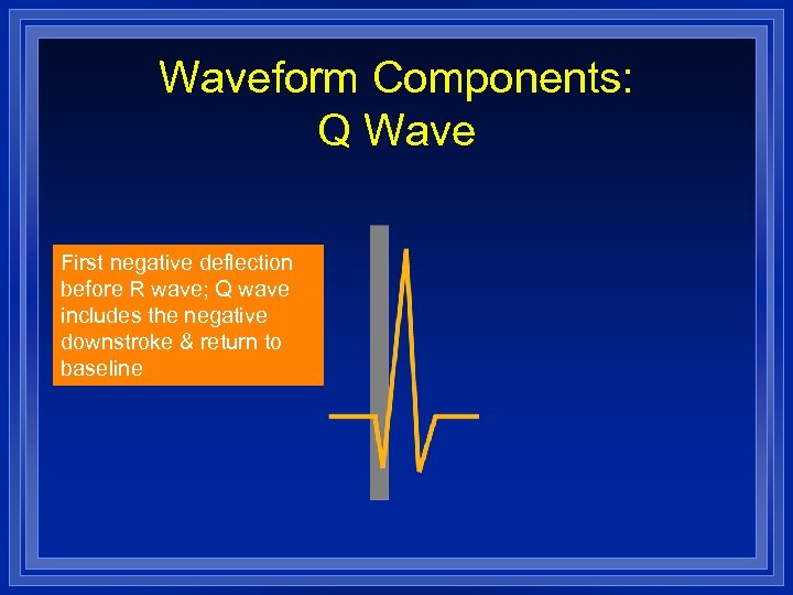 Waveform Components: Q Wave First negative deflection before R wave; Q wave includes the