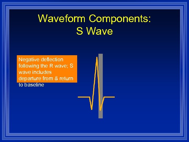 Waveform Components: S Wave Negative deflection following the R wave; S wave includes departure