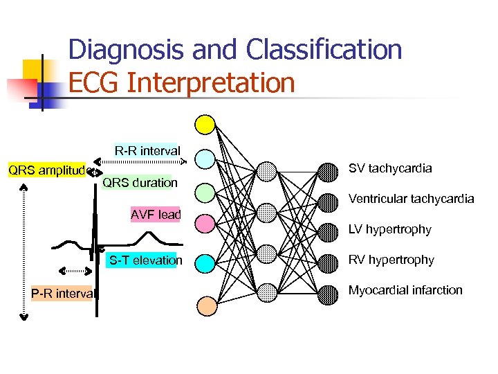 Diagnosis and Classification ECG Interpretation R-R interval QRS amplitude SV tachycardia QRS duration Ventricular