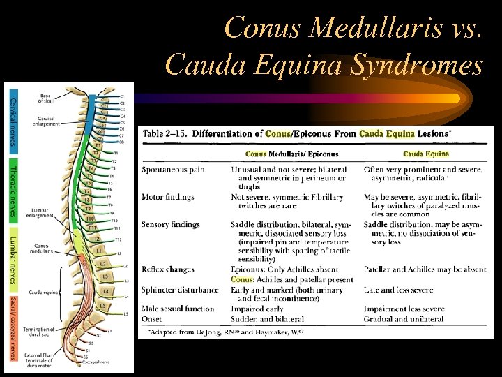Conus Medullaris vs. Cauda Equina Syndromes 