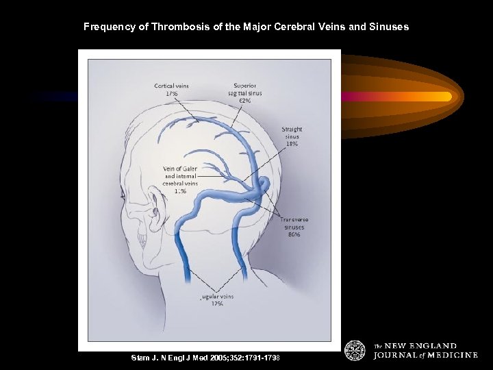 Frequency of Thrombosis of the Major Cerebral Veins and Sinuses Stam J. N Engl