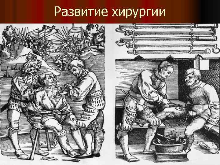 Развитие хирургии 