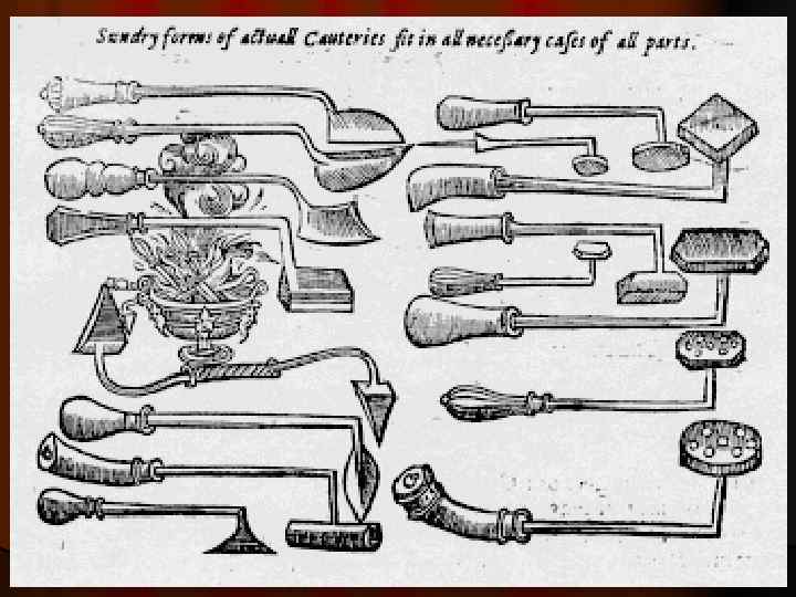 Инструменты возрождения. Амбруаз паре хирургические инструменты. Амбруаз паре инструменты и протезы. Инструменты хирургии Амбруаза паре.