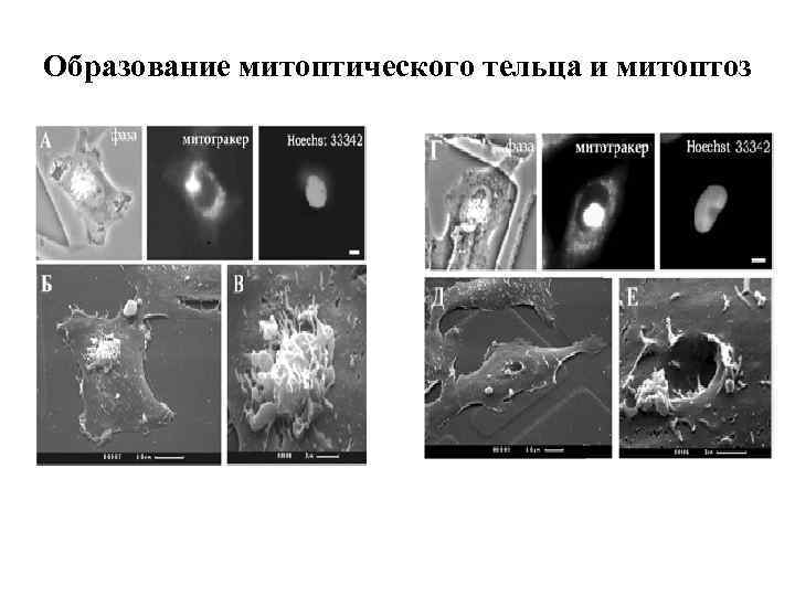 Образование митоптического тельца и митоптоз . 