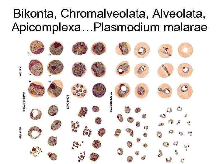 Bikonta, Chromalveolata, Apicomplexa…Plasmodium malarae 