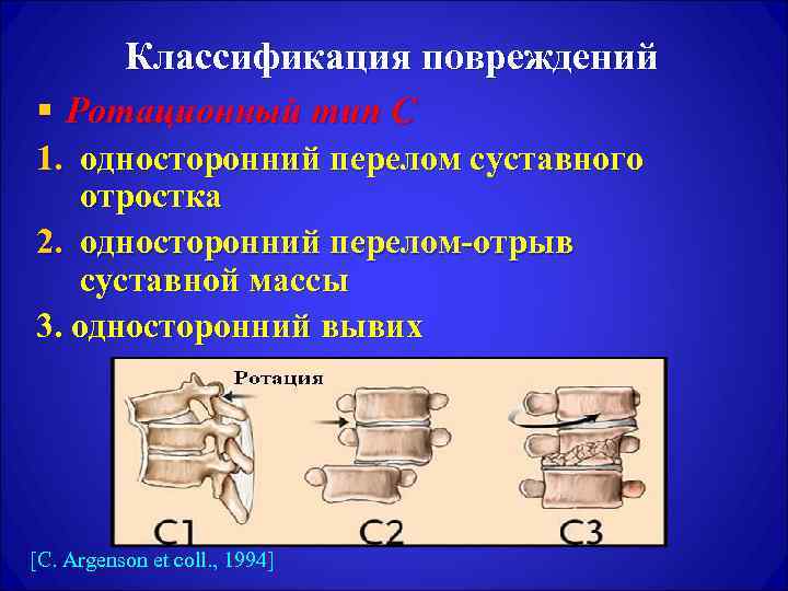 Классификация повреждений § Ротационный тип С 1. односторонний перелом суставного отростка 2. односторонний перелом-отрыв