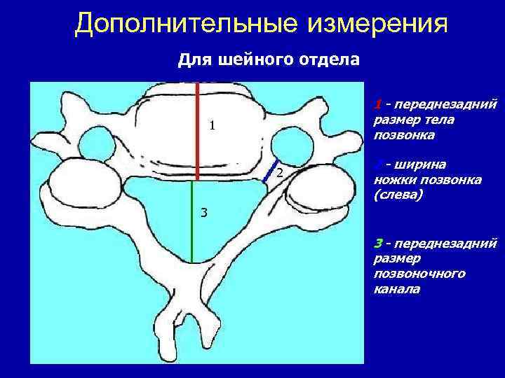 Дополнительные измерения Для шейного отдела 1 - переднезадний размер тела позвонка 1 2 2