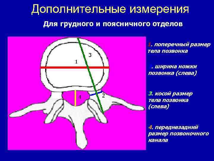 Дополнительные измерения Для грудного и поясничного отделов 1. поперечный размер тела позвонка 3 1