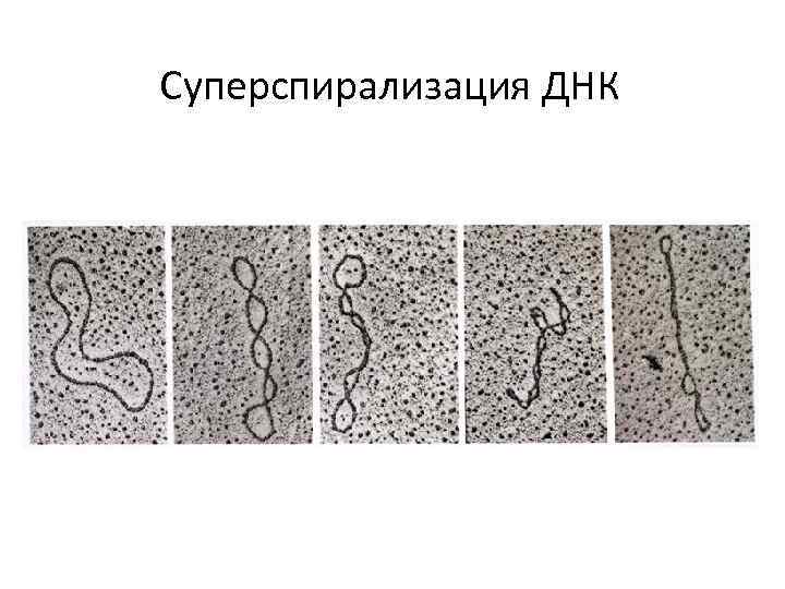 Суперспирализация ДНК 