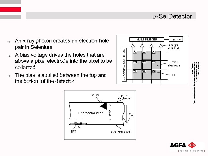  -Se Detector ® ® Dr. Martin Yaffe, Imaging Research Program, Sunnybrook and Women's