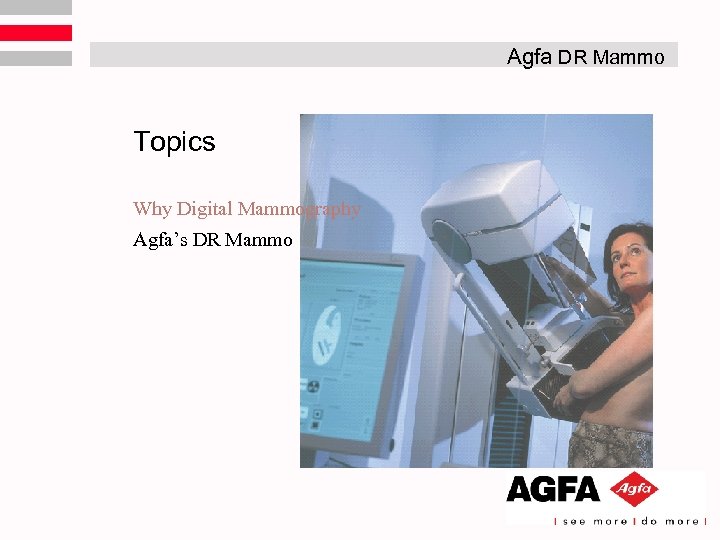 Agfa DR Mammo Topics Why Digital Mammography Agfa’s DR Mammo 