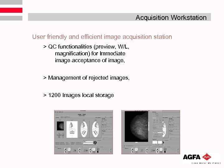 Acquisition Workstation User friendly and efficient image acquisition station > QC functionalities (preview, W/L,