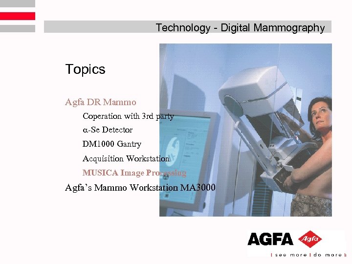 Technology - Digital Mammography Topics Agfa DR Mammo Coperation with 3 rd party -Se