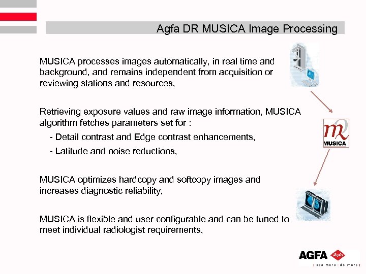 Agfa DR MUSICA Image Processing MUSICA processes images automatically, in real time and background,