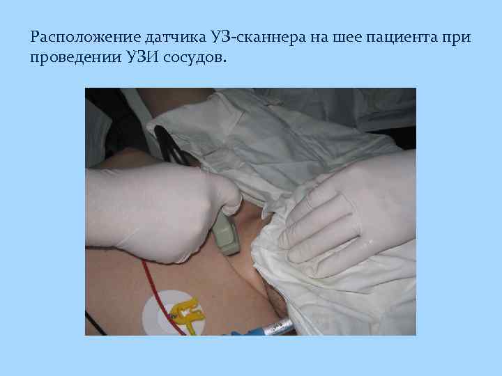 Расположение датчика УЗ-сканнера на шее пациента при проведении УЗИ сосудов. 