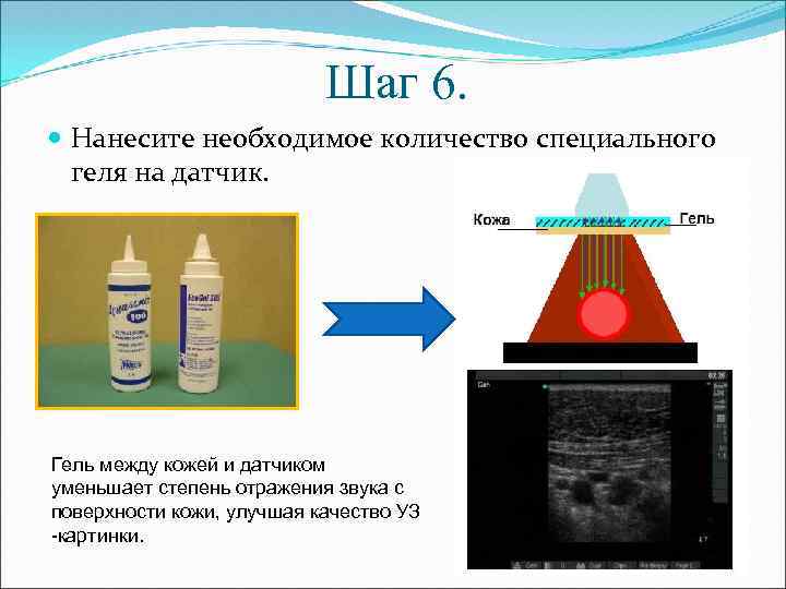 Шаг 6. Нанесите необходимое количество специального геля на датчик. Гель между кожей и датчиком