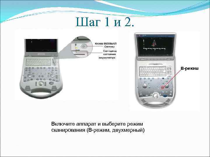 Шаг 1 и 2. Включите аппарат и выберите режим сканирования (В-режим, двухмерный) 
