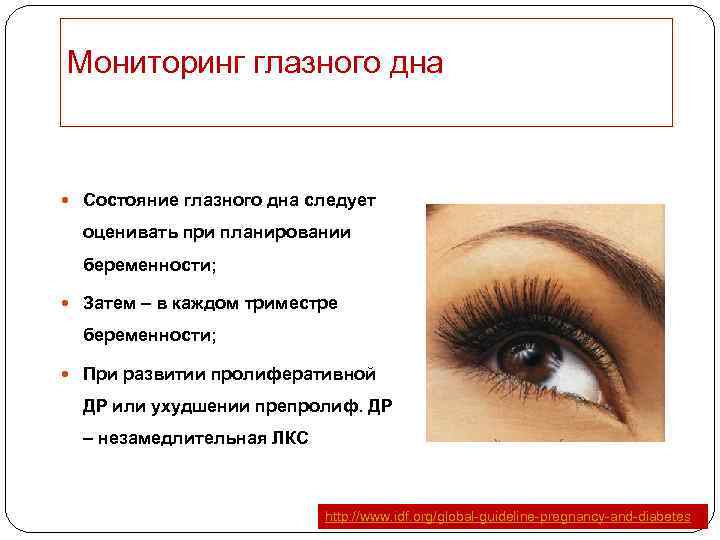 Мониторинг глазного дна Состояние глазного дна следует оценивать при планировании беременности; Затем – в