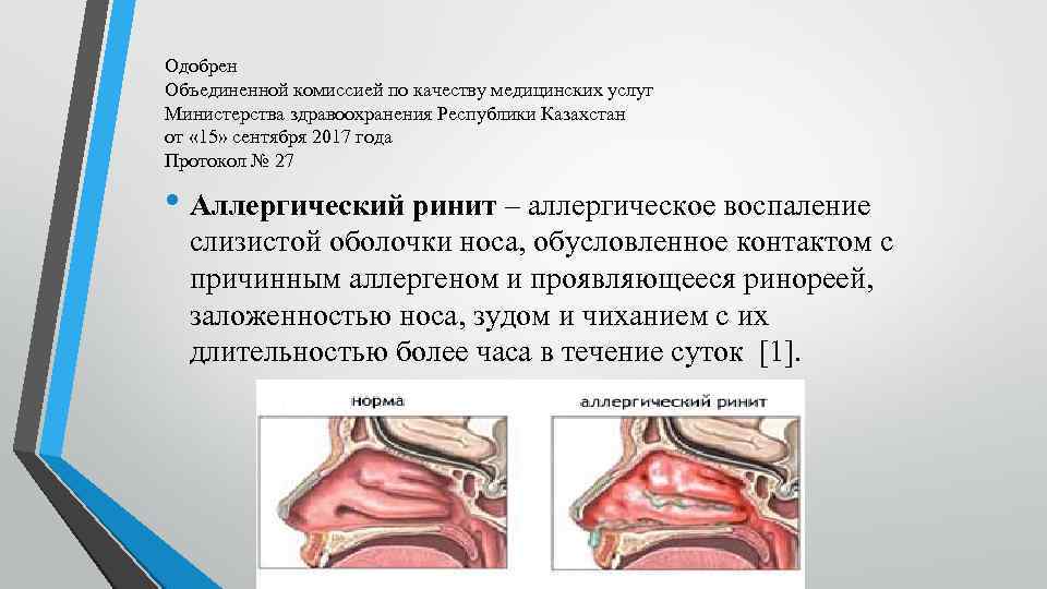 Одобрен Объединенной комиссией по качеству медицинских услуг Министерства здравоохранения Республики Казахстан от « 15»