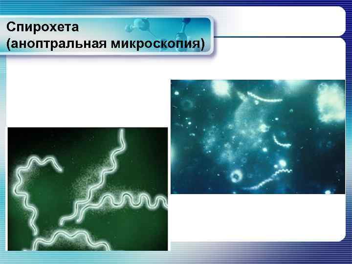Спирохета (аноптральная микроскопия) 
