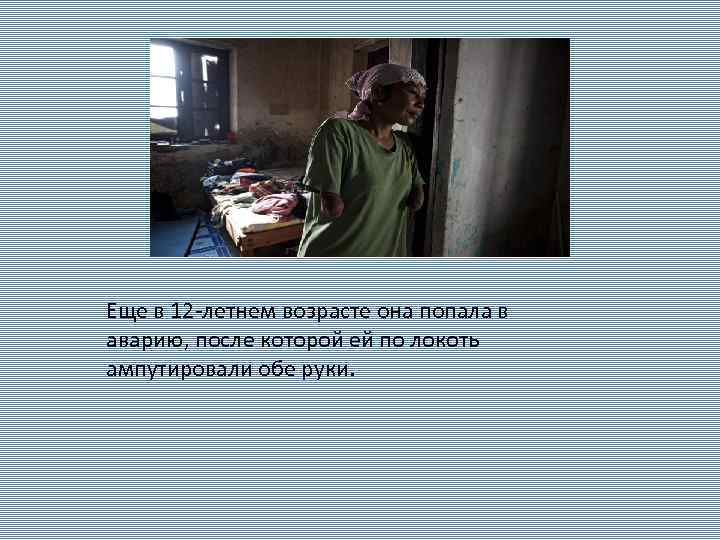 Еще в 12 -летнем возрасте она попала в аварию, после которой ей по локоть