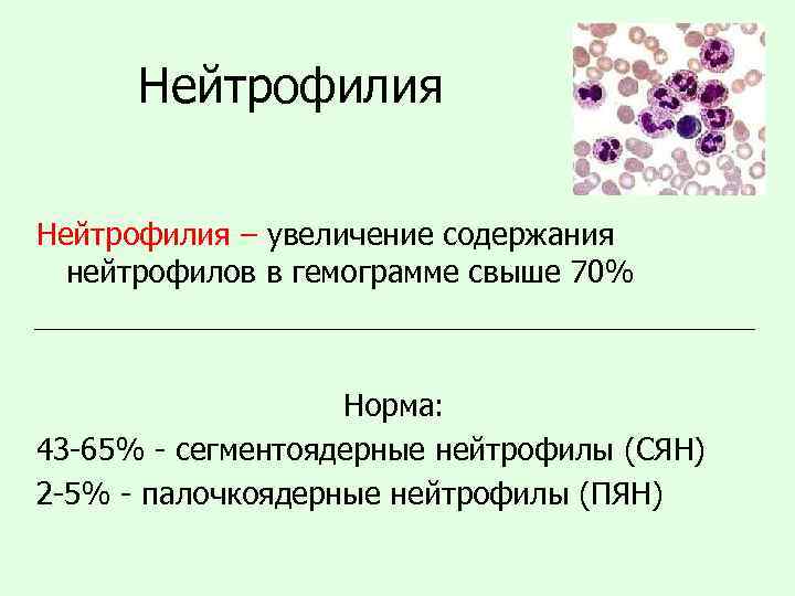 Нейтрофилия – увеличение содержания нейтрофилов в гемограмме свыше 70% Норма: 43 -65% - сегментоядерные