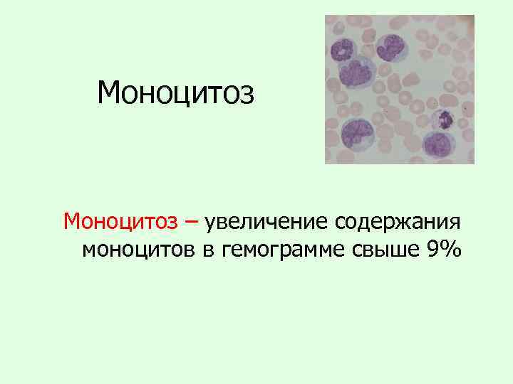 Моноцитоз – увеличение содержания моноцитов в гемограмме свыше 9% 