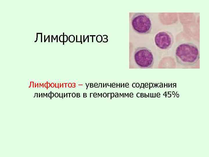 Лимфоцитоз – увеличение содержания лимфоцитов в гемограмме свыше 45% 