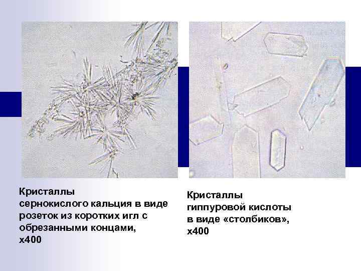 Кристаллы сернокислого кальция в виде розеток из коротких игл с обрезанными концами, х400 Кристаллы