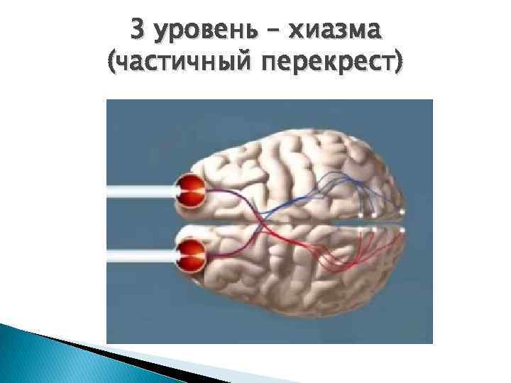 3 уровень – хиазма (частичный перекрест) 