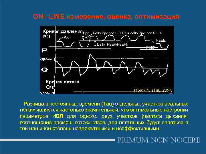 ON –LINE измерение, оценка, оптимизация Кривая давления. Ppc P/ t Ppc Delta Ppc nad