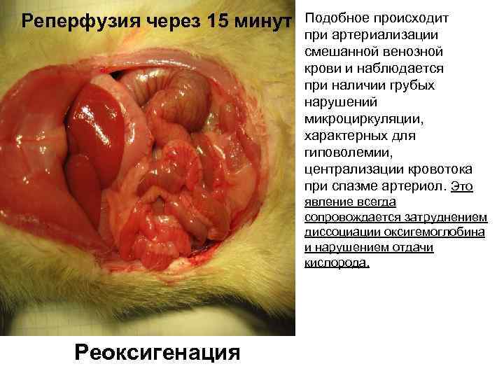 Реперфузия через 15 минут Подобное происходит при артериализации смешанной венозной крови и наблюдается при
