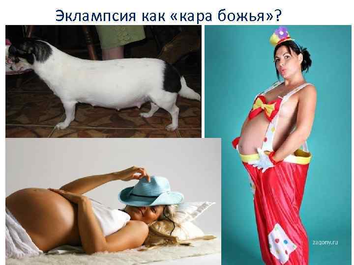 Эклампсия как «кара божья» ? 