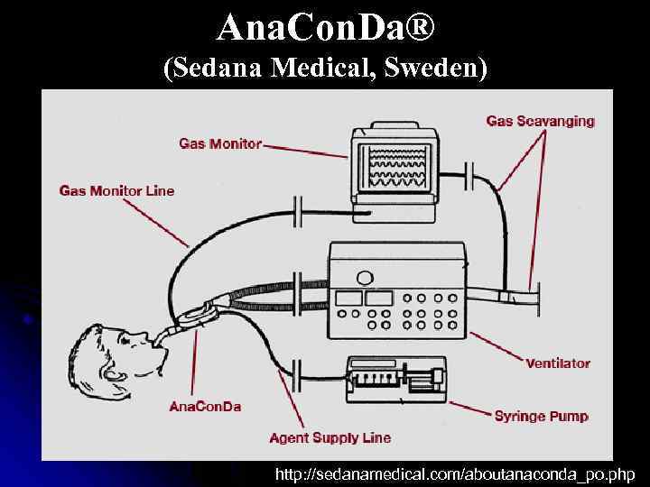 Ana. Con. Da® (Sedana Medical, Sweden) http: //sedanamedical. com/aboutanaconda_po. php 