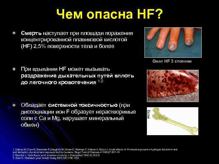 Чем опасна HF? Смерть наступает при площади поражения концентрированной плавиковой кислотой (HF) 2, 5%