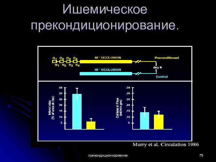 Ишемическое прекондиционирование 79 