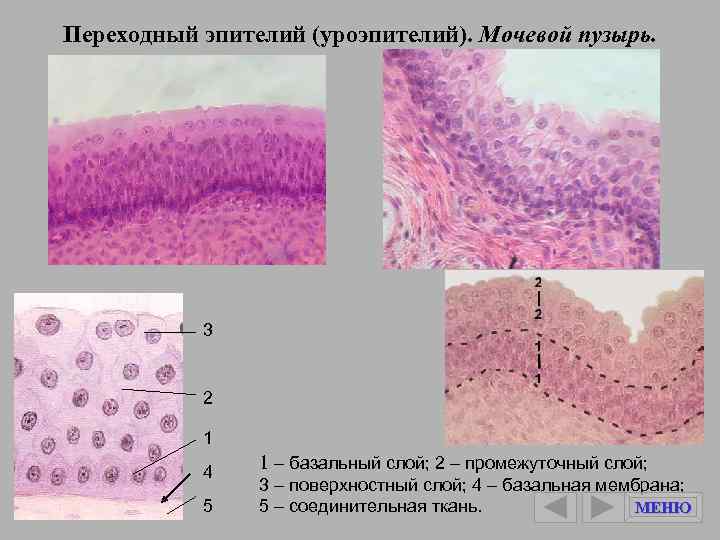 Плоский поверхностный промежуточный эпителий. Однослойный плоский эпителий серозной оболочки. Многослойный переходный эпителий. Переходный эпителий уроэпителий мочевой пузырь. , Плоский эпителий серозных оболочек.