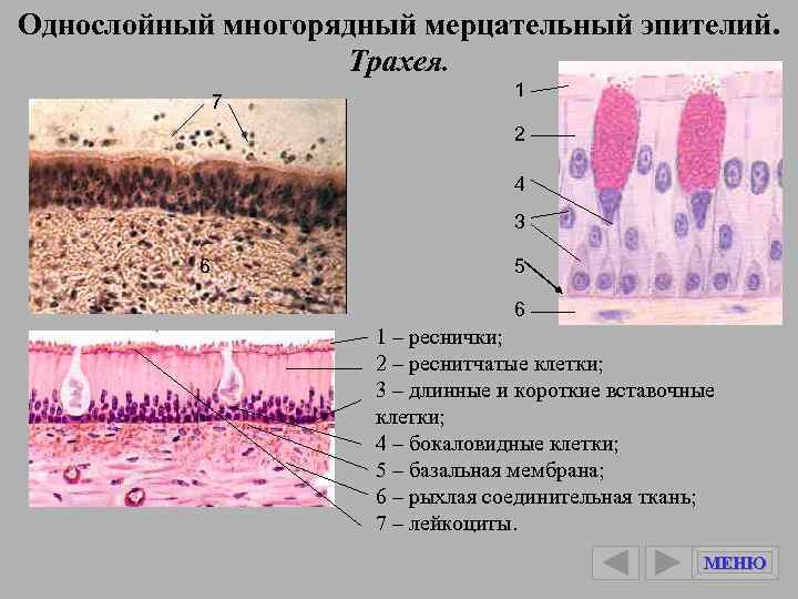 Трахея препарат гистология рисунок с подписями